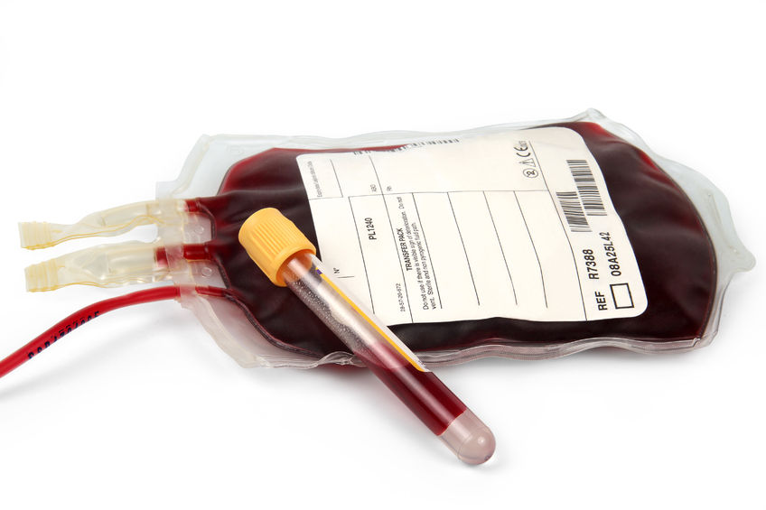 Blood Thinners and Breast Surgery
