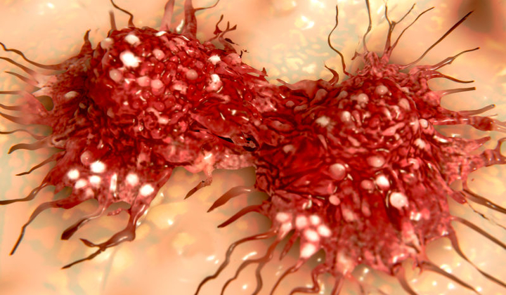 Breast Cancer Genomics