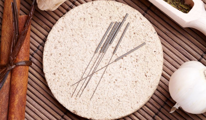 Acupuncture