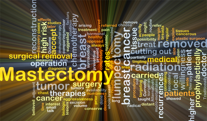 Mastectomy