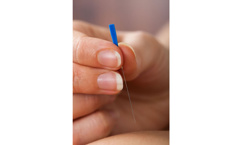 Acupuncture Is an Effective Agent to Combat Hot Flashes in Women with Breast Cancer